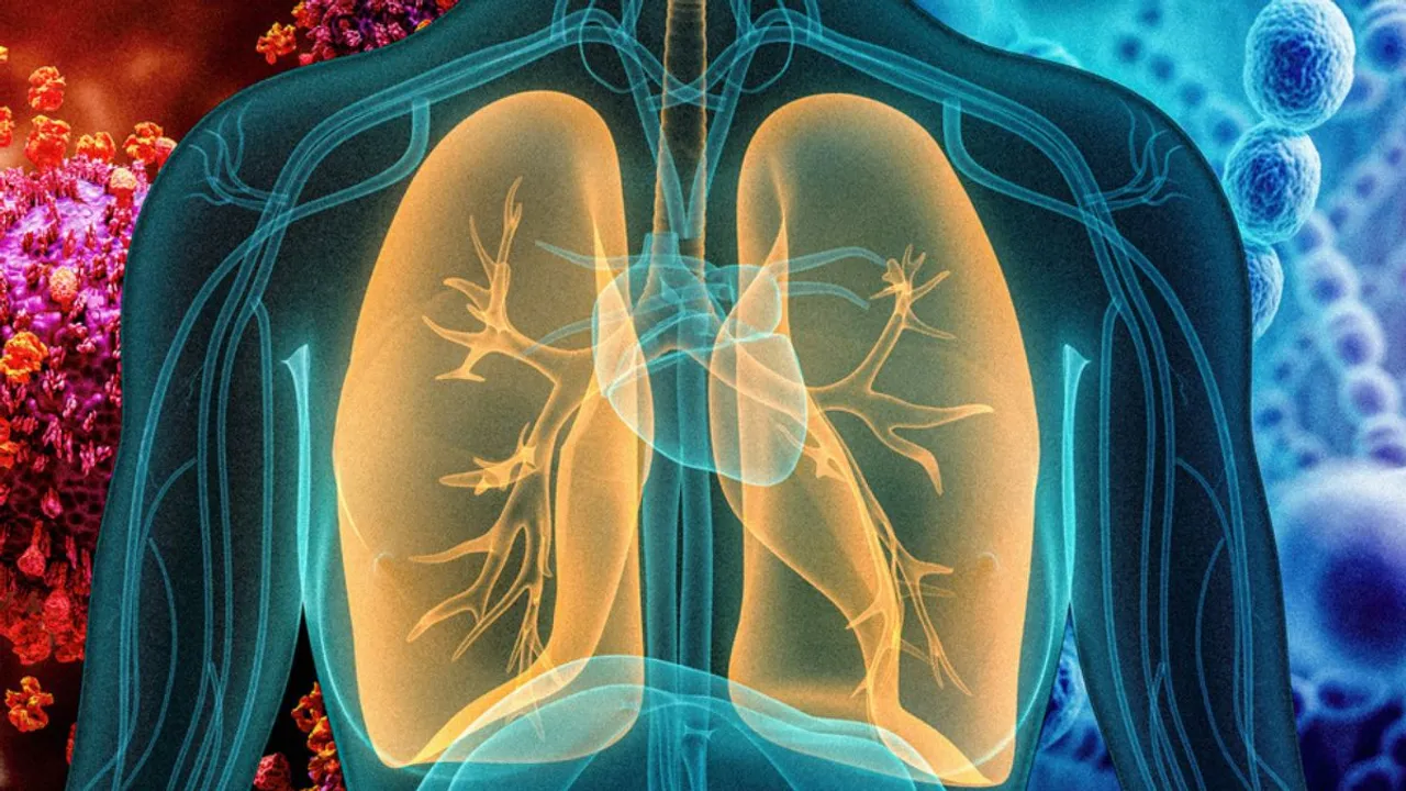  Pneumonia  Photograph:(Instagram) 