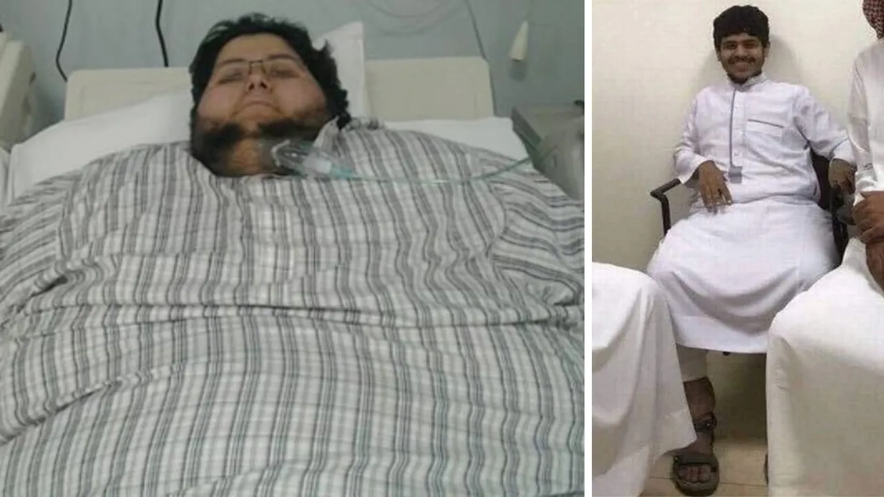  Image of Khalid bin Mohsen Shaari when he weighed 610kg and after he lost weight. Photograph:(Others) 