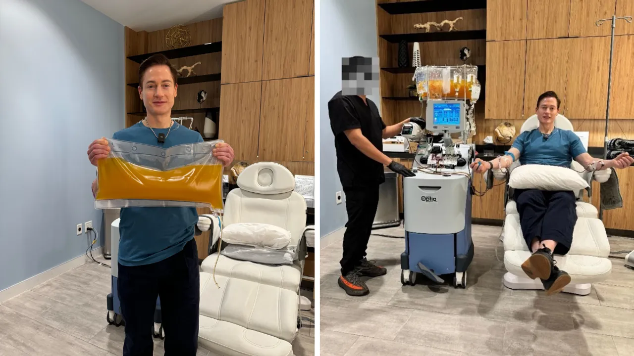  Image of millionaire Bryan Johnson with his plasma. Photograph:(X) 