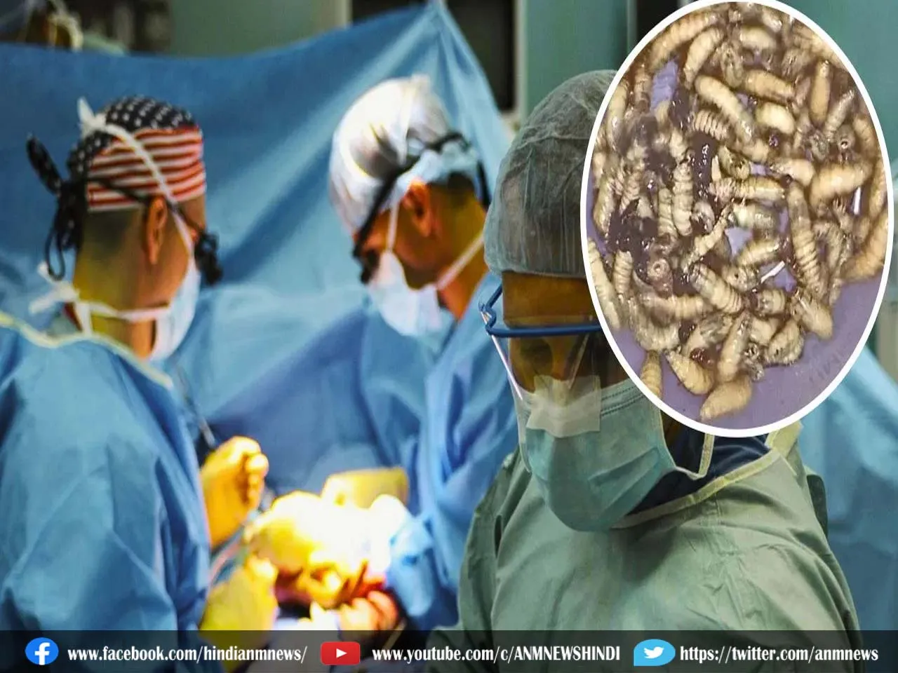 डॉक्टर भी दंग, नाक के अंदर 150 जिंदा कीड़े