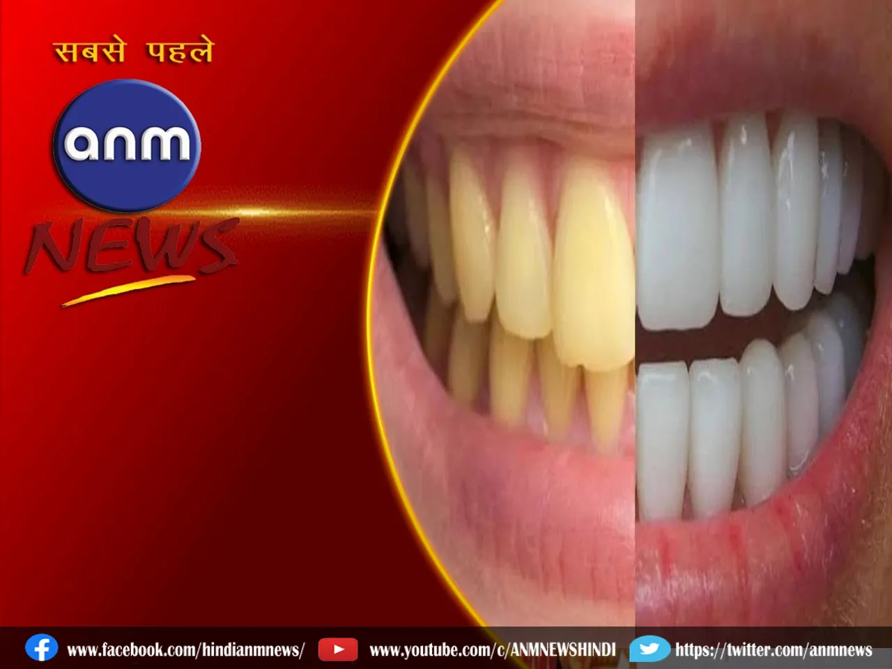 Lifestyle: जानिए दांतो के पीलेपन कैसे करे दूर