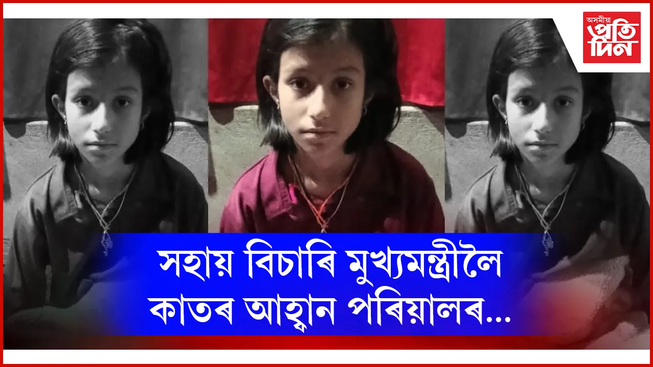 ১৩বছৰীয়া কন্যা জটিল ৰোগত আক্ৰান্ত