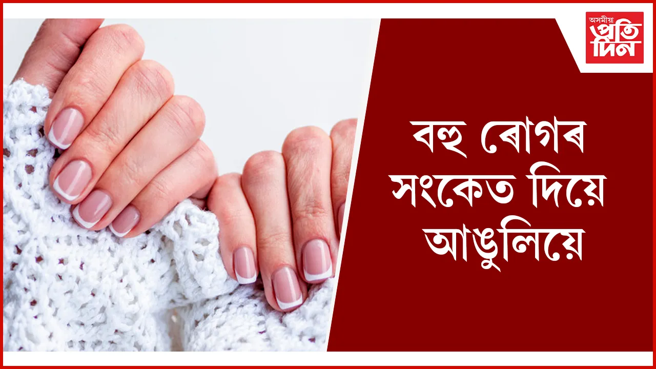 ৪৪৪৪৪৪৪৪৪৪৪৪৪৪৪৪৪৪৪৪৪৪৪৪৪