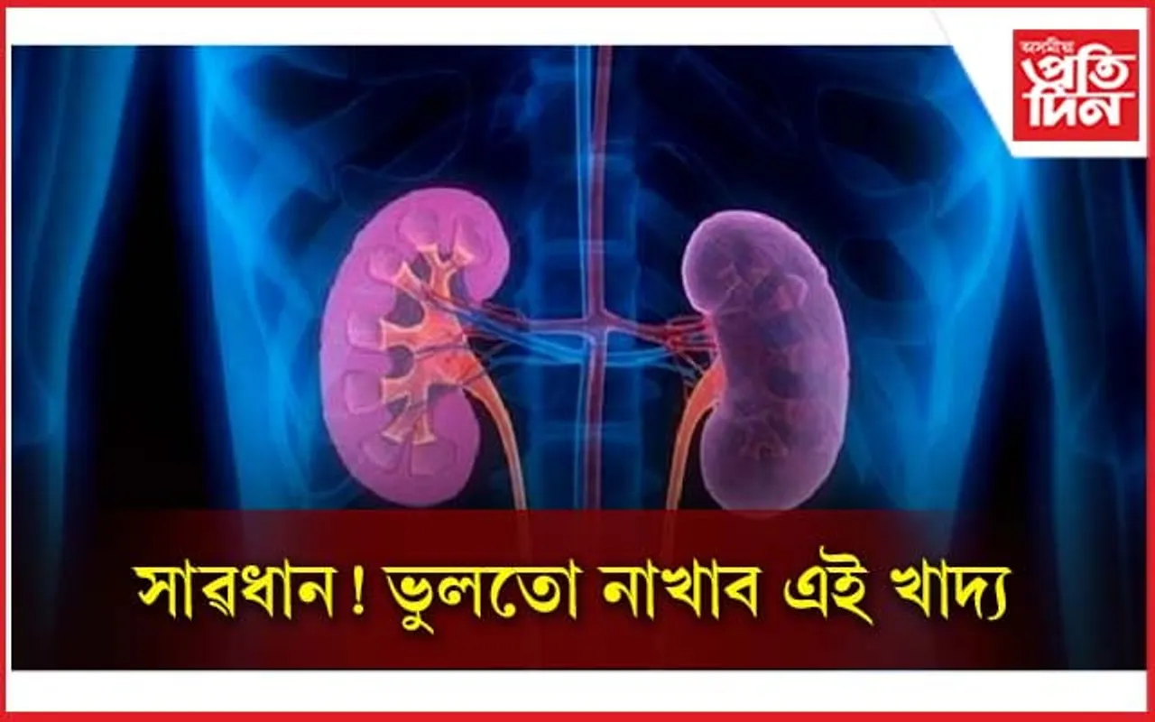‘কিডনী ষ্ট’ন’ হ’লে কি খাব লাগে জানি লওঁক 