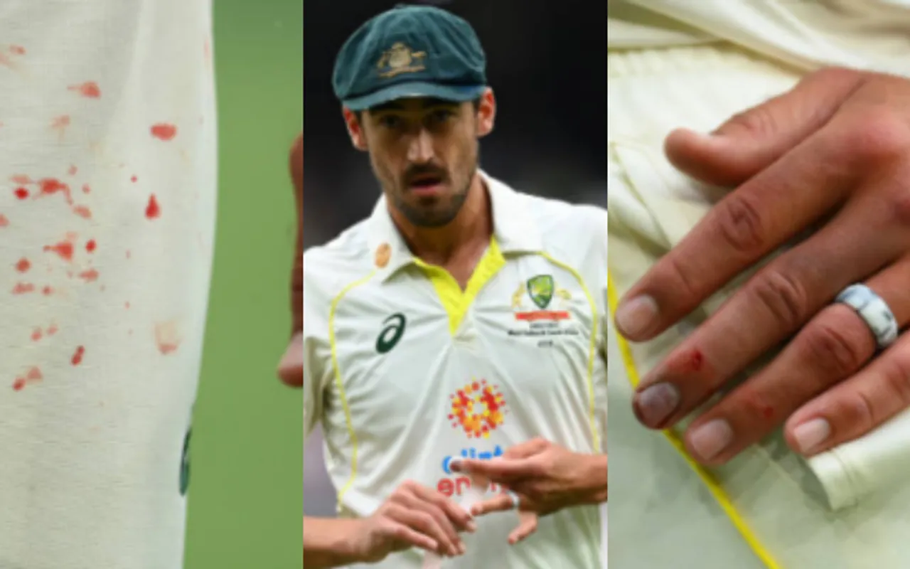 ‘Dedication at it’s best’ - Fans salute Mitchell Starc for bowling on Day 3 of MCG Test despite finger injury