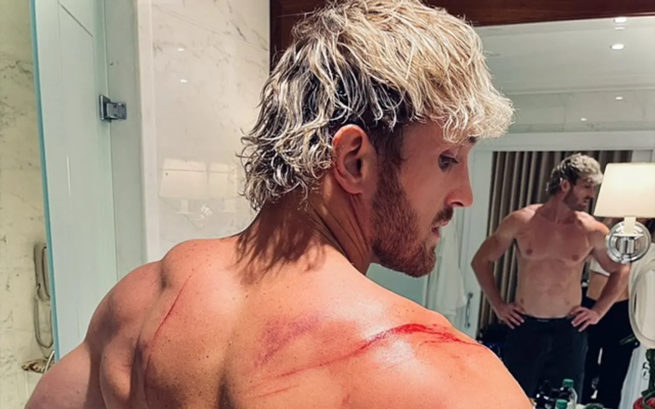 'Humein bhi bohot acha lagta hai' - Fans react to Logan Paul sharing an update on his injury following WWE Money in the Bank 2023