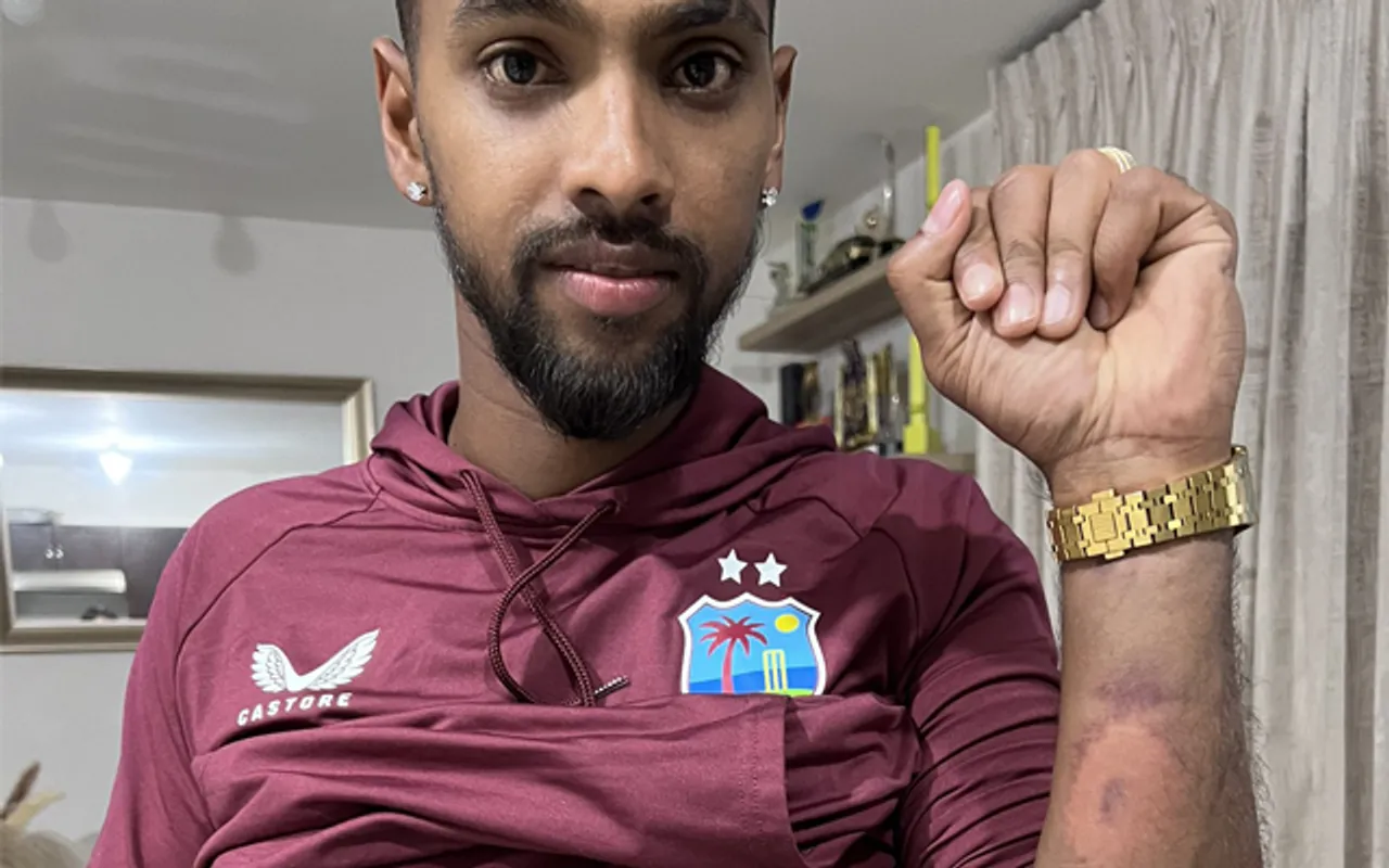'Kash hamare batters aisa khelte' - Fans react to Nicholas Pooran's pictures showing his injuries after 5th T20I against West Indies