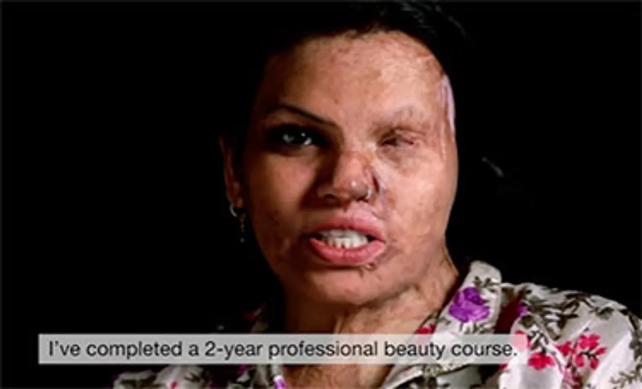 Don't cringe on seeing our faces: Acid attack survivors share video CVs