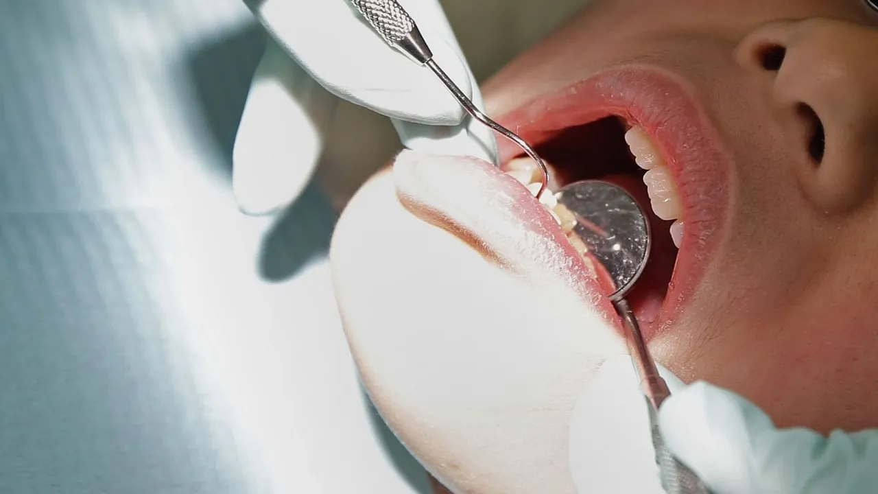 EU's Landmark Decision to Ban Mercurybased Dental Amalgam A Step