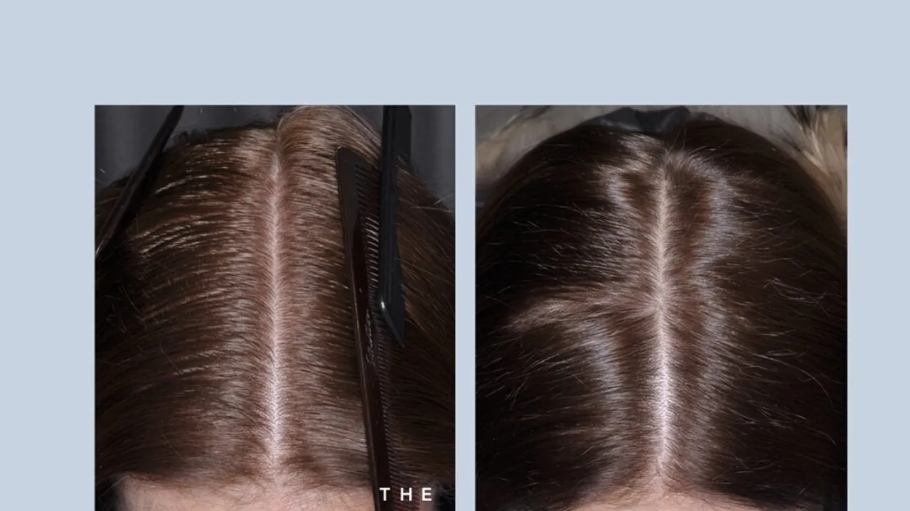 iD Collective Teams Up with The Hairy Pill for Nationwide 'Grow On