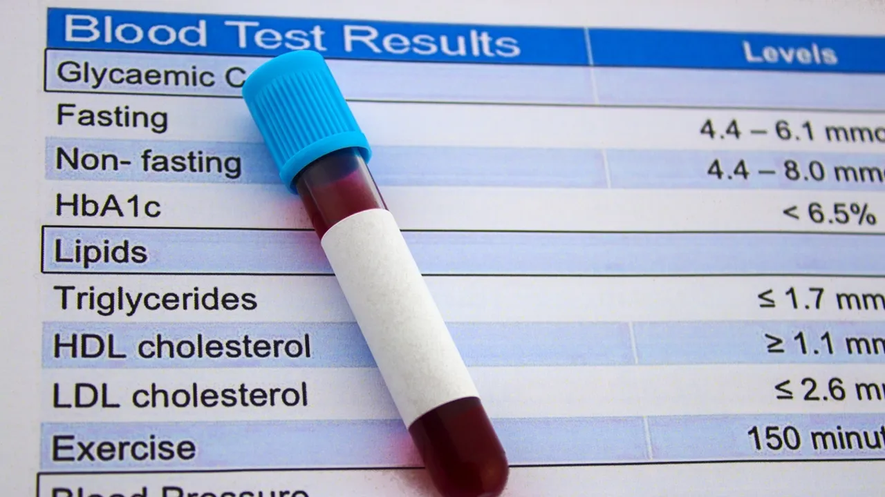 Rethinking Cholesterol Tests Fasting Not Always Necessary, Say Experts