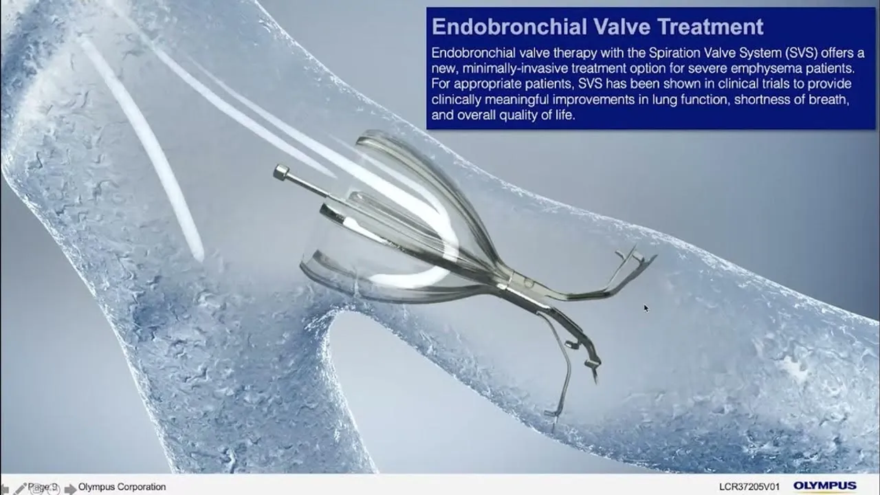 Olympus Canada Launches Spiration Valve System for Severe Emphysema Treatment
