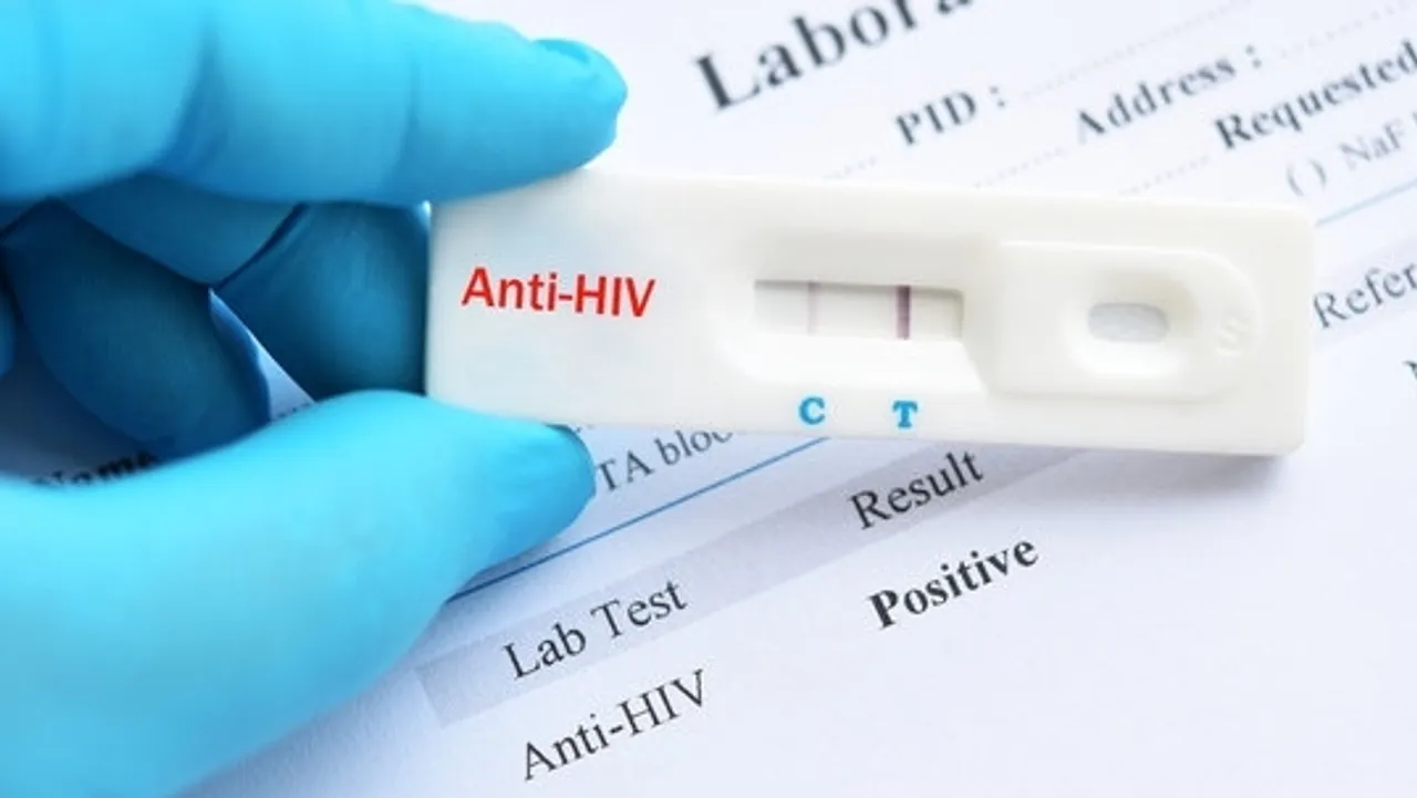 Sri Lanka Witnesses Surge in HIV Infections Among 20-30 Year Olds, Says Health Official