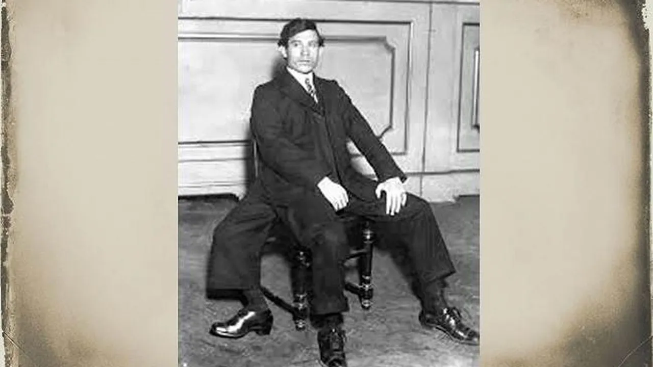 The Extraordinary Life of Francesco Lentini The ThreeLegged Man