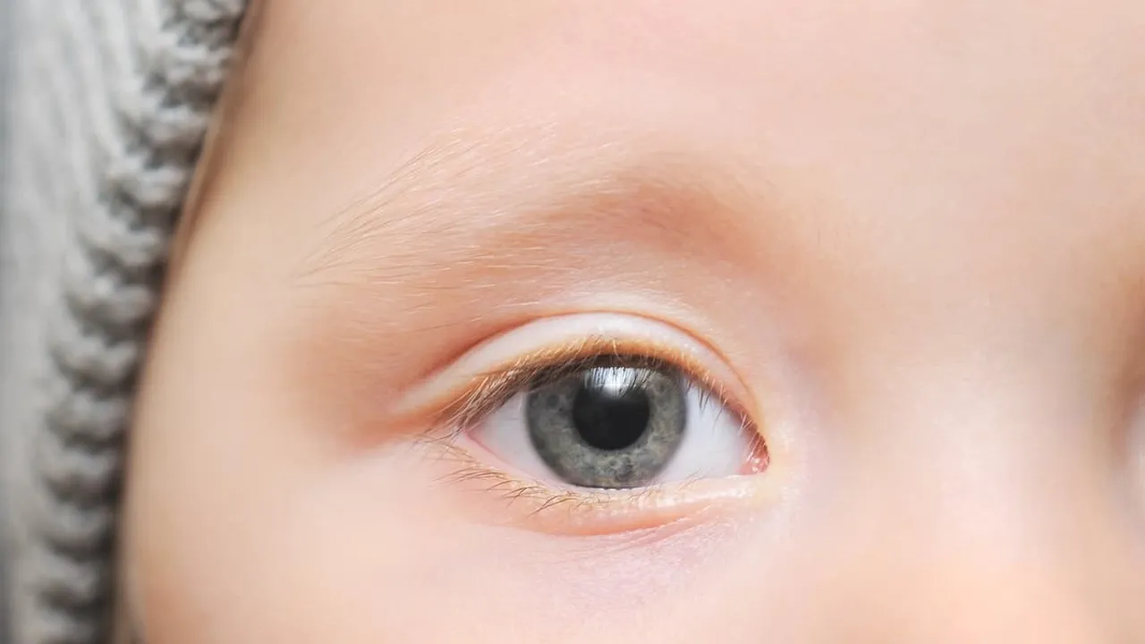 AI Tool Accurately Diagnoses Autism in Children, Reveals Korean Study