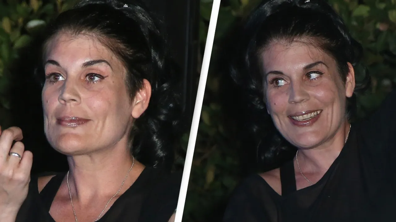 Anastasia Synn's Technological Implants A Guinness World Record and a