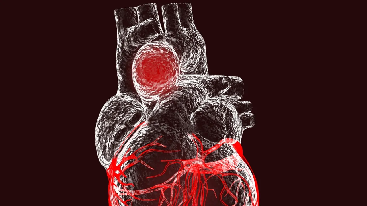 CedarsSinai's Smidt Heart Institute Debuts Aortic Surveillance Clinic