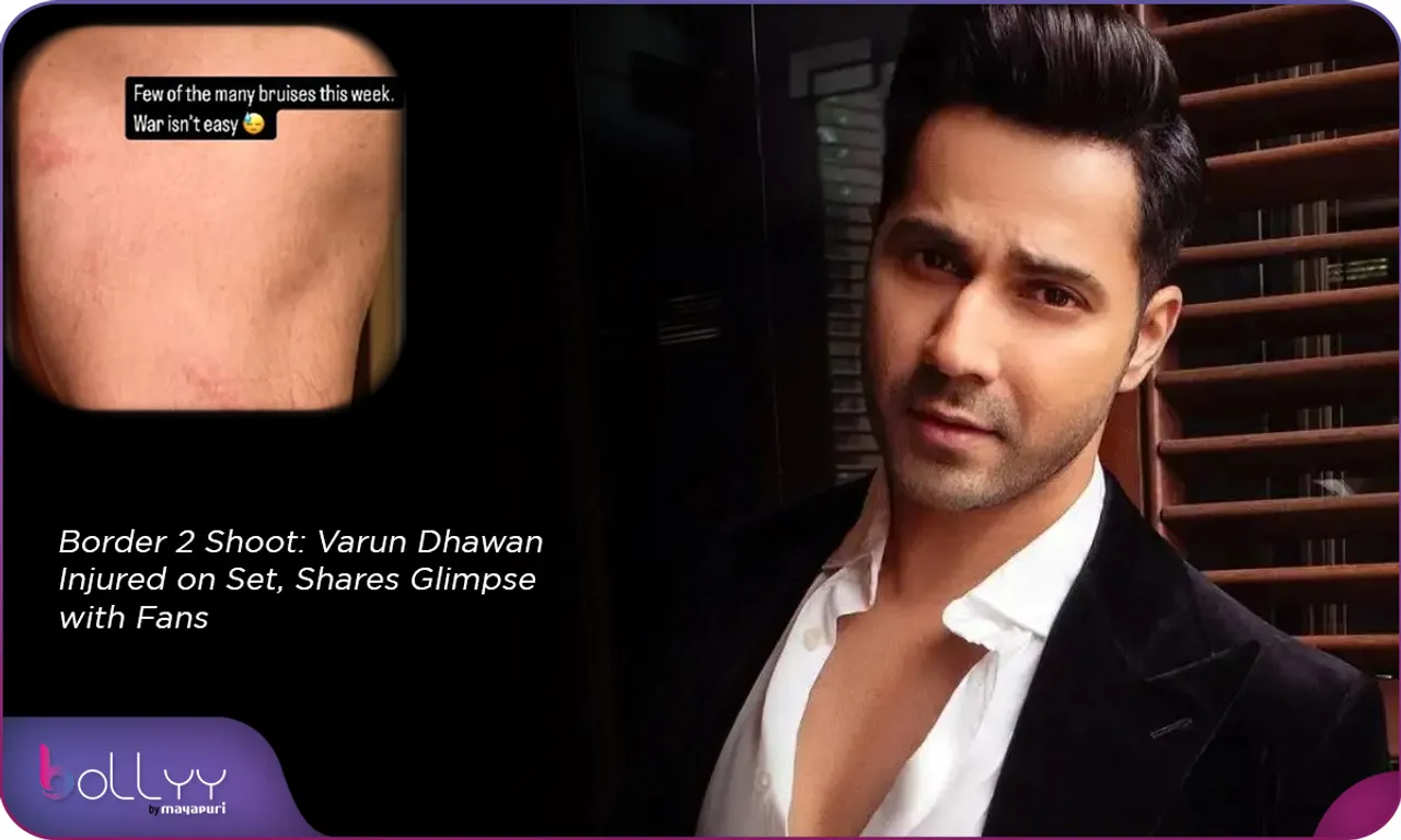 Border 2 Shoot Varun Dhawan Injured on Set, Shares Glimpse with Fans