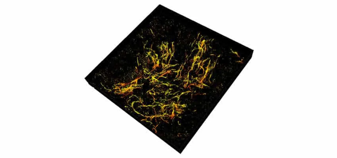 3D Imaging nanoscope