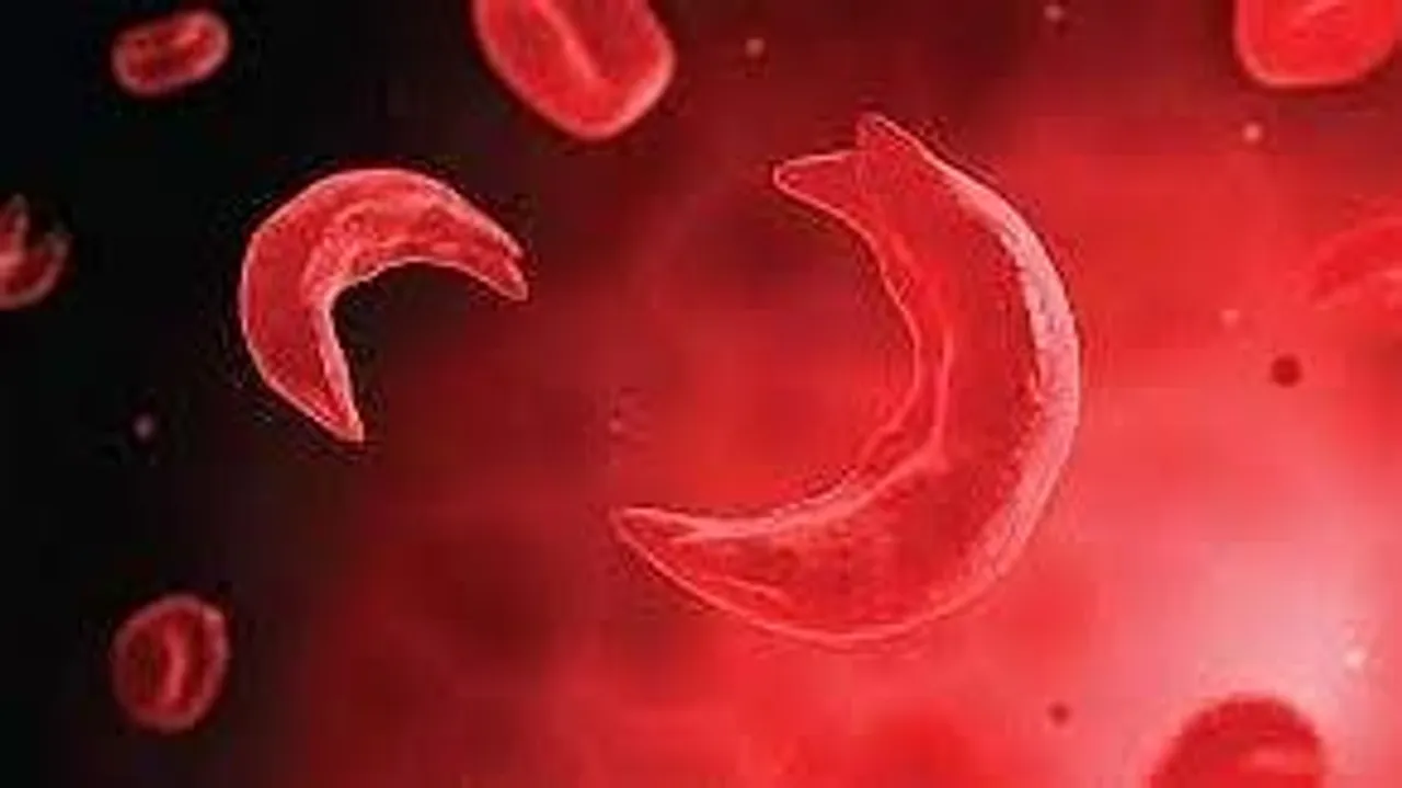 Tribal Rajasthan faces Sickle Cell surge 10,000+ cases