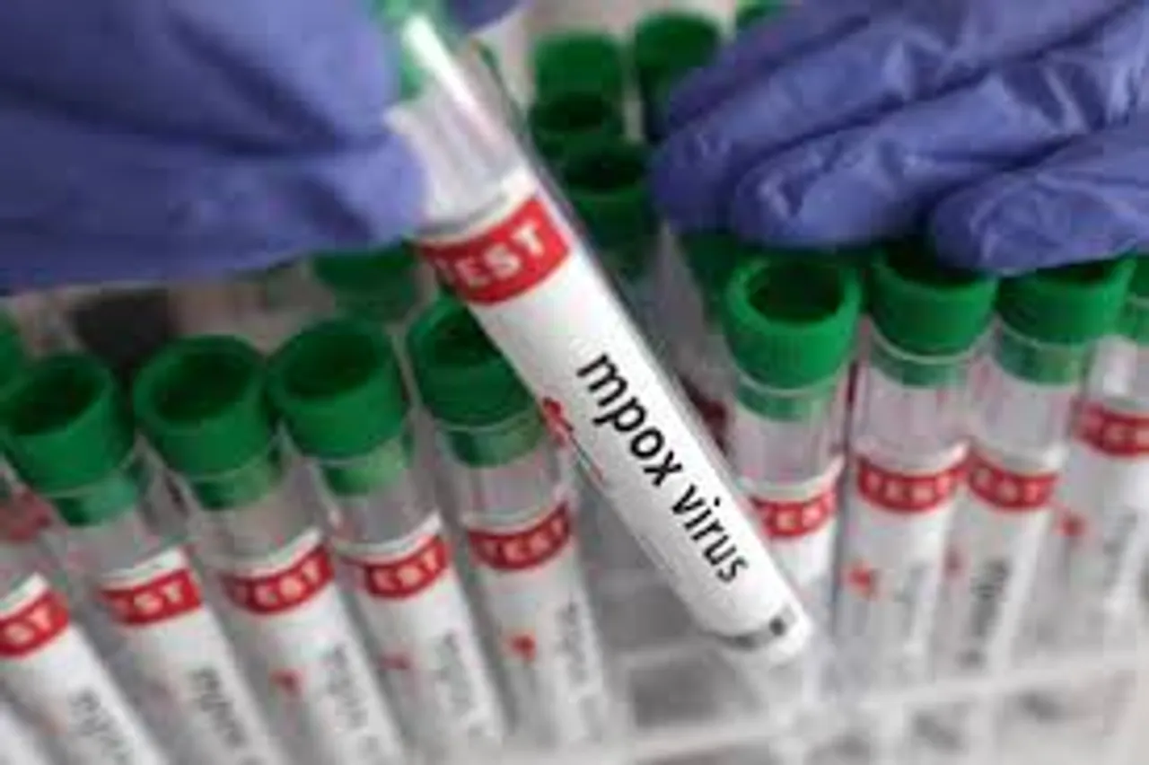New York health department confirms first case of new mpox strain