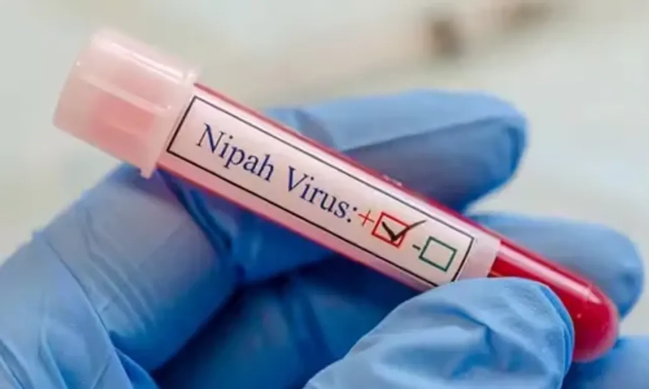 Nipah virus can cause severe infection in children, experts suggest cautionary measures