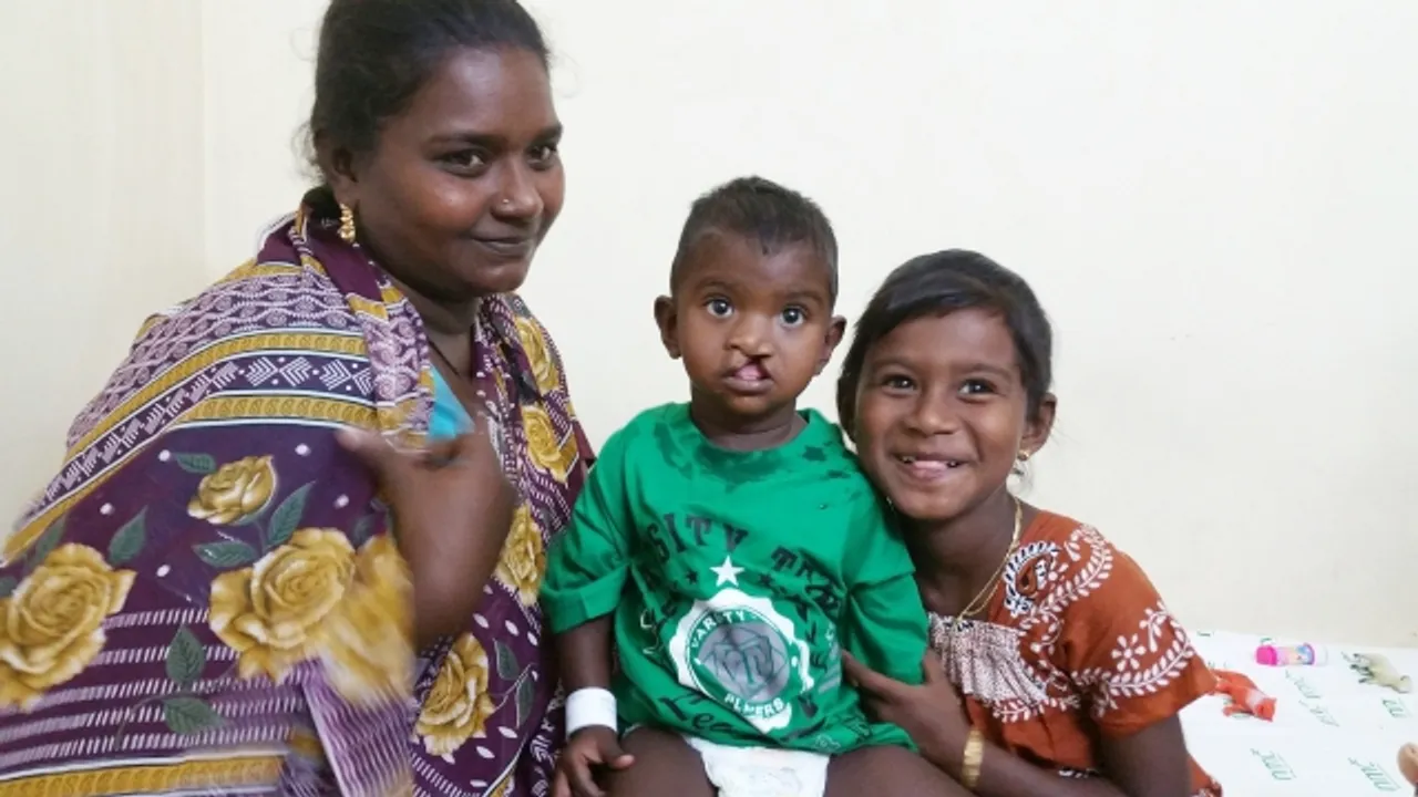 Muthoot Pappachan Foundation Facilitates 1,000 Free Cleft Lip & Palate Surgeries