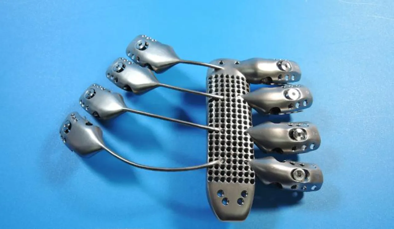 Cancer patient receives 3D printed ribs