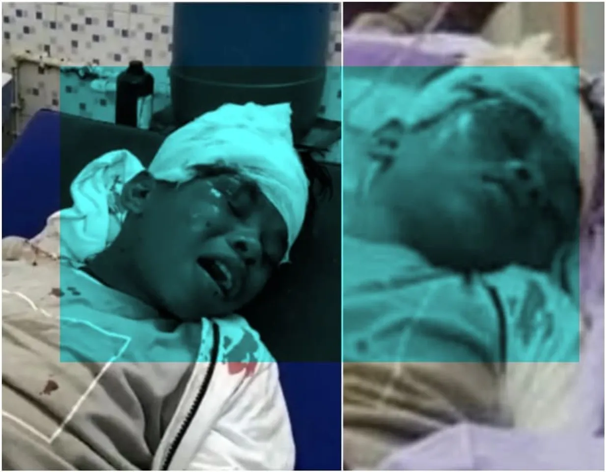 Bachpan Ka Pyaar boy Sahdev Dirdo critically injured