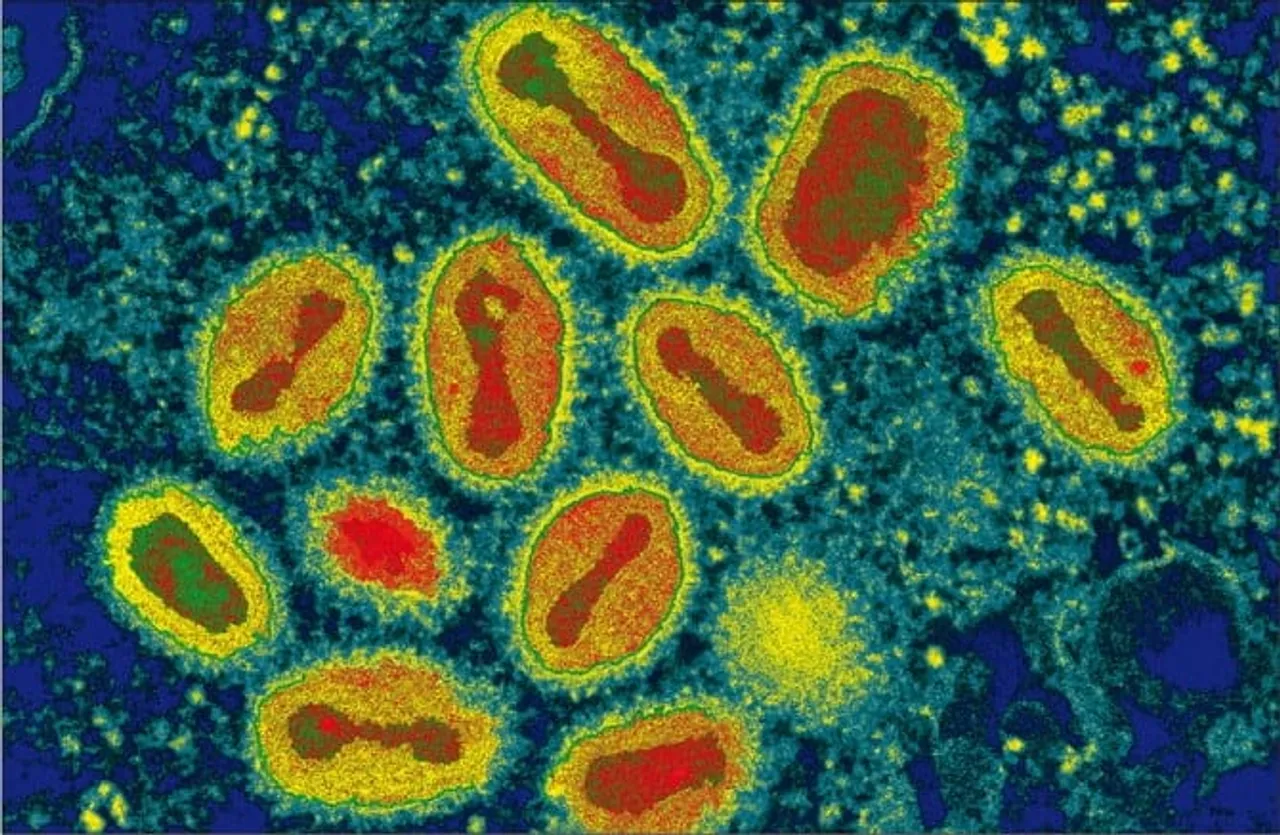 The ten most dangerous viruses in the world