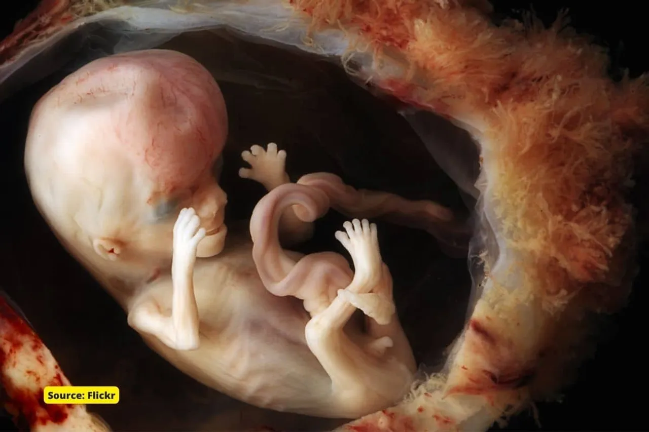 What makes a fetus a person?