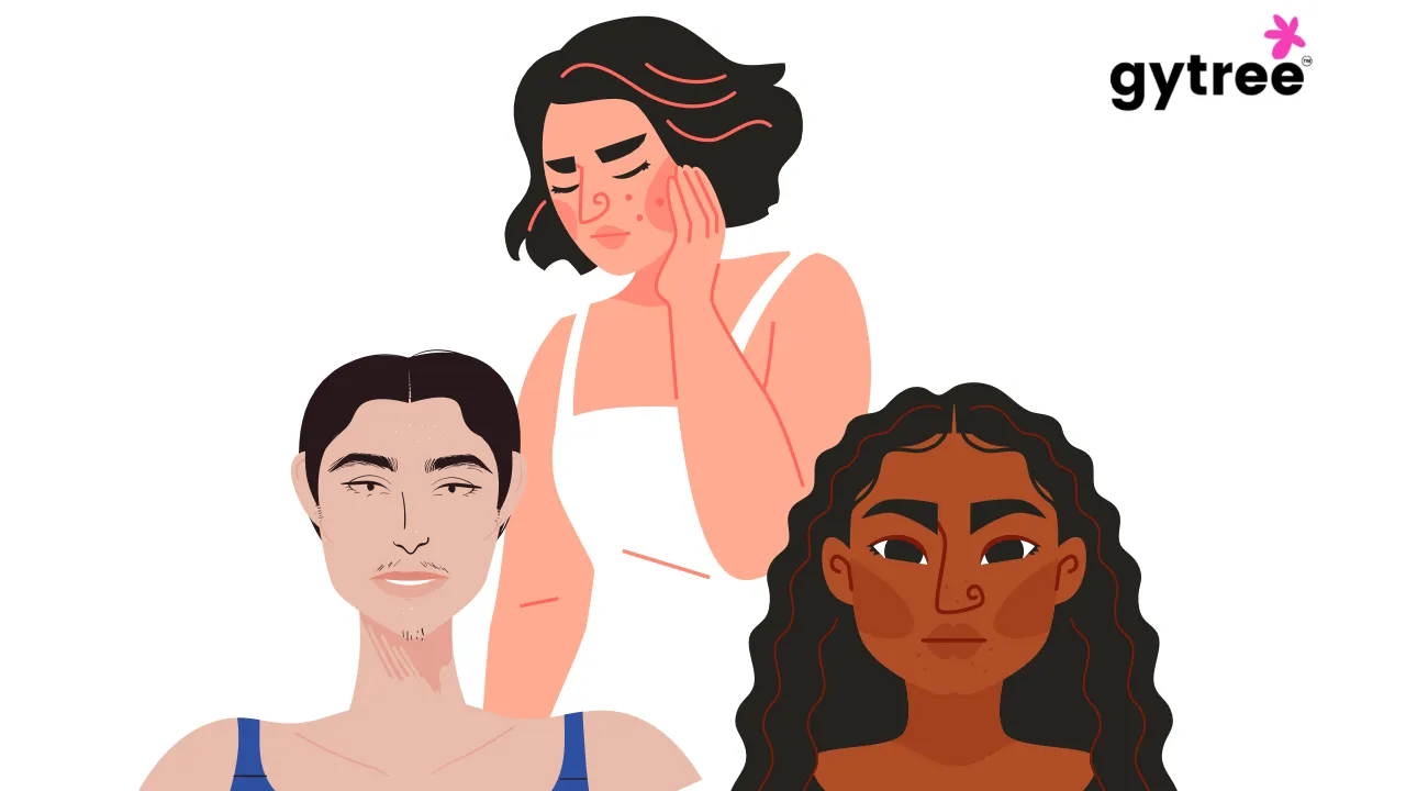 can-pcos-cause-darkening-of-skin