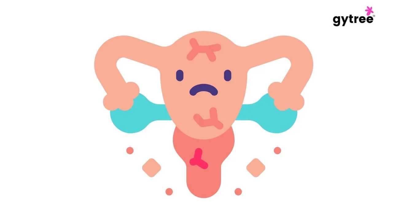 Things you should know about vaginal dryness