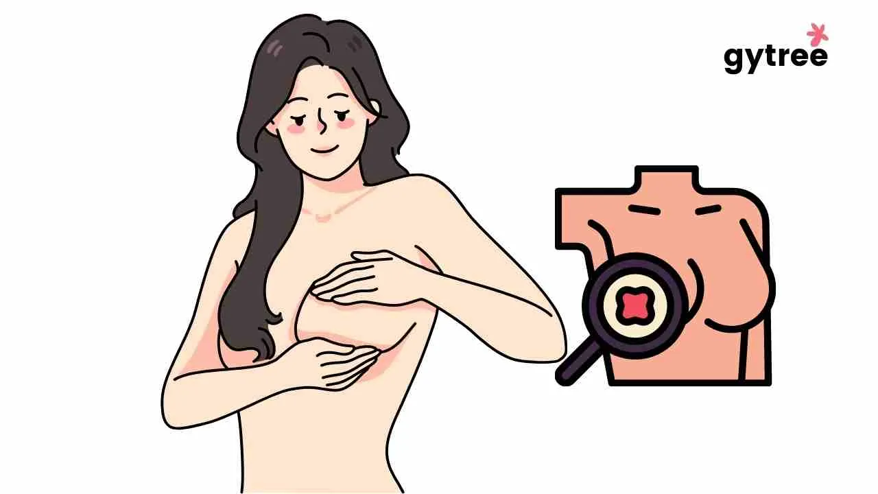 Self Breast Examination