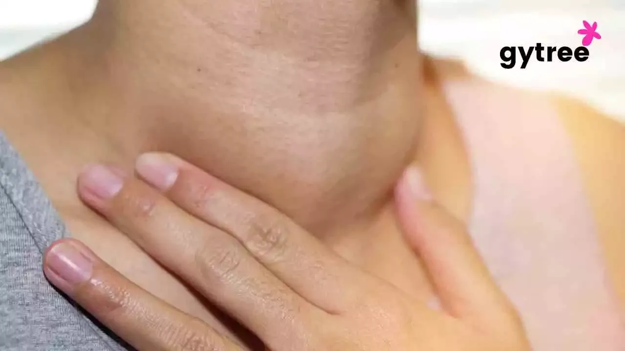 Goiter: Symptoms, Causes and Treatment