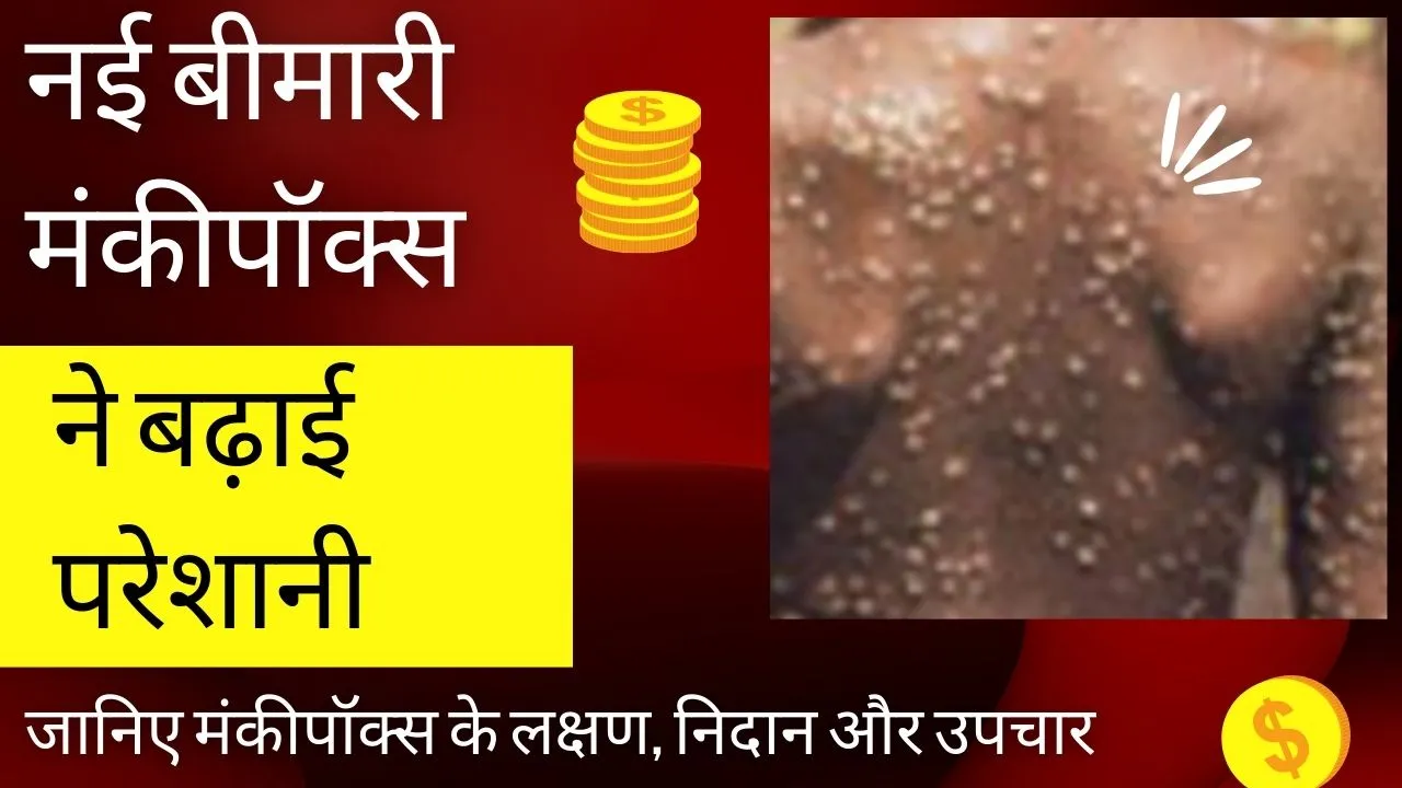 डब्ल्यूएचओ ने मंकीपॉक्स को वैश्विक स्वास्थ्य संबंधी आपातस्थिति घोषित किया