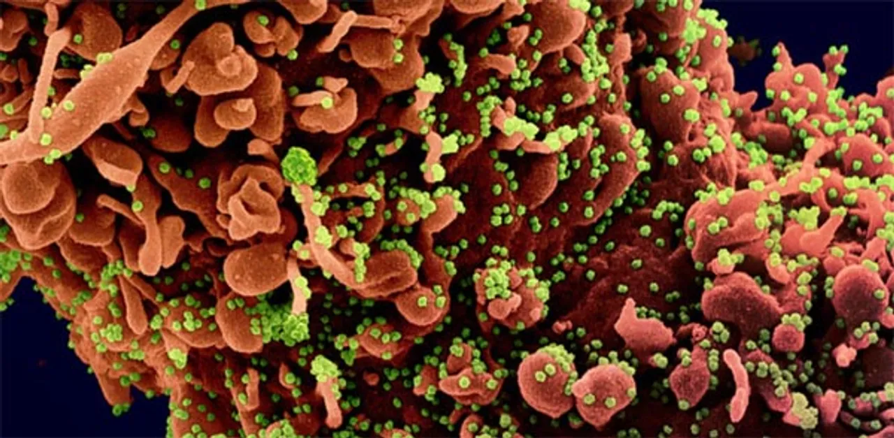 रूपांतरित कोरोना वायरस की पहचान में सक्षम नई आरटी-पीसीआर किट : दावा