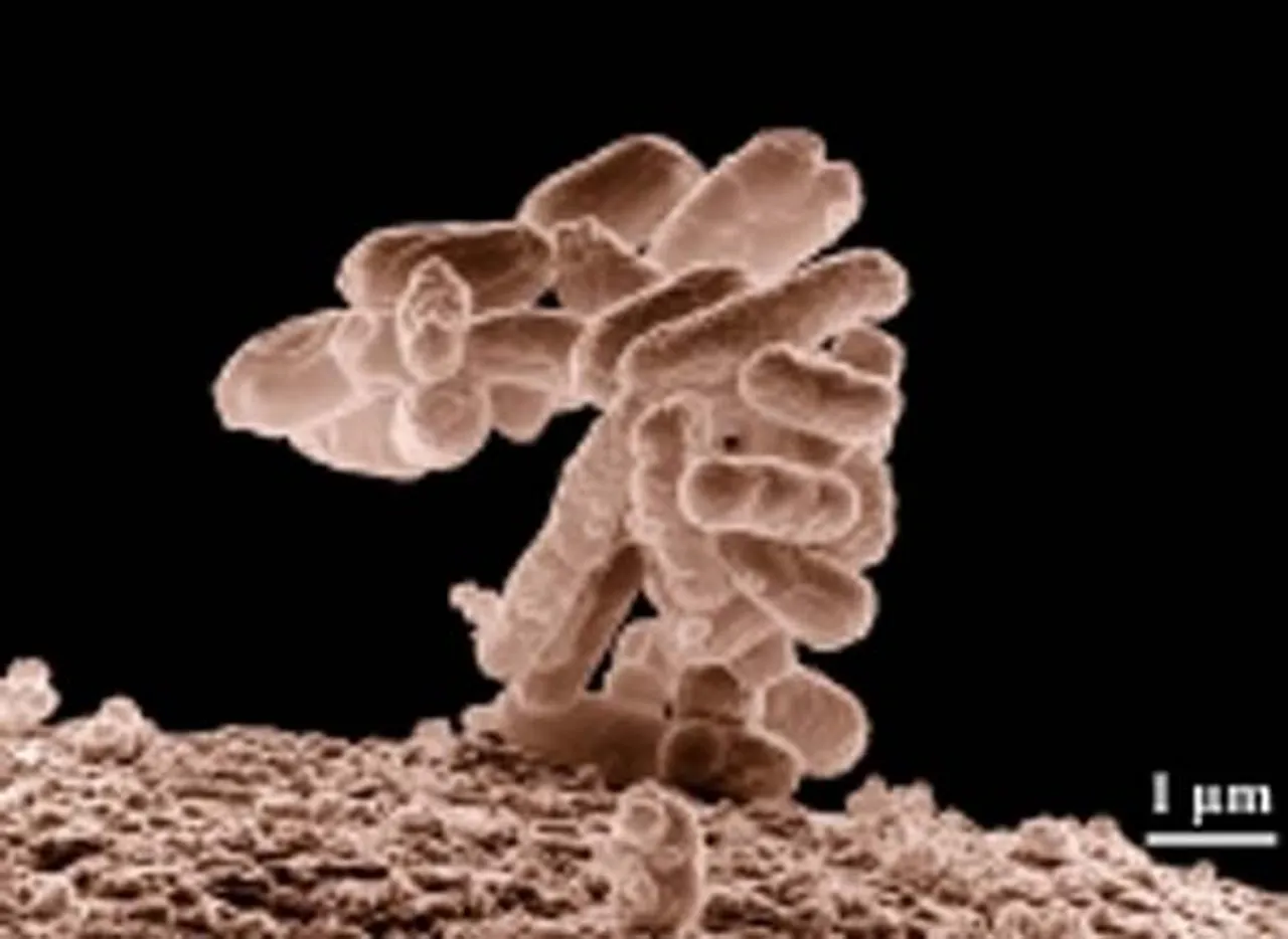 प्रदूषण से भी बढ़ रही है रोगजनक बैक्टीरिया में प्रतिरोधक क्षमता