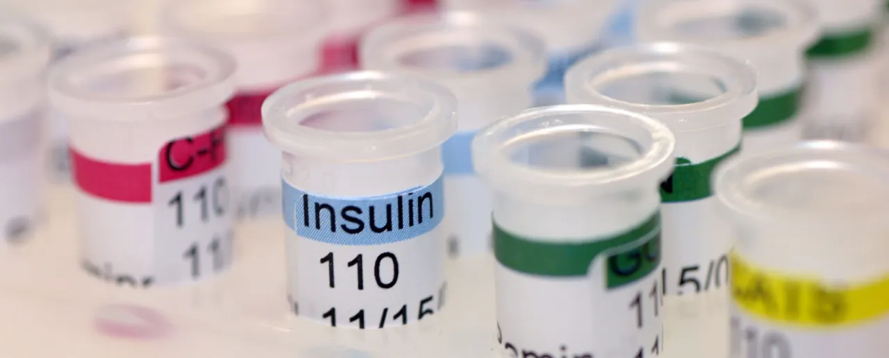 Insulin Levels : जानें उच्च इंसुलिन स्तर के 5 संकेत