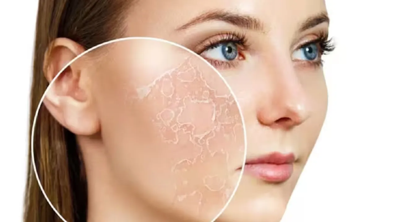 skin dryness 1