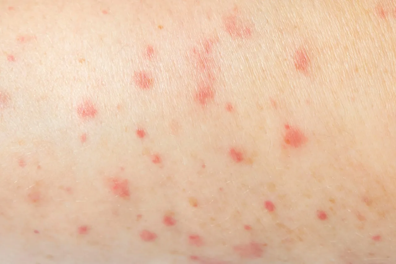 Red bumps