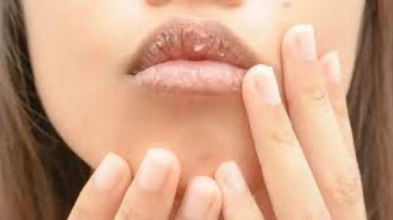 Winter Lip Care: सर्दियों में फटे होठों की देखभाल के 5 तरीके