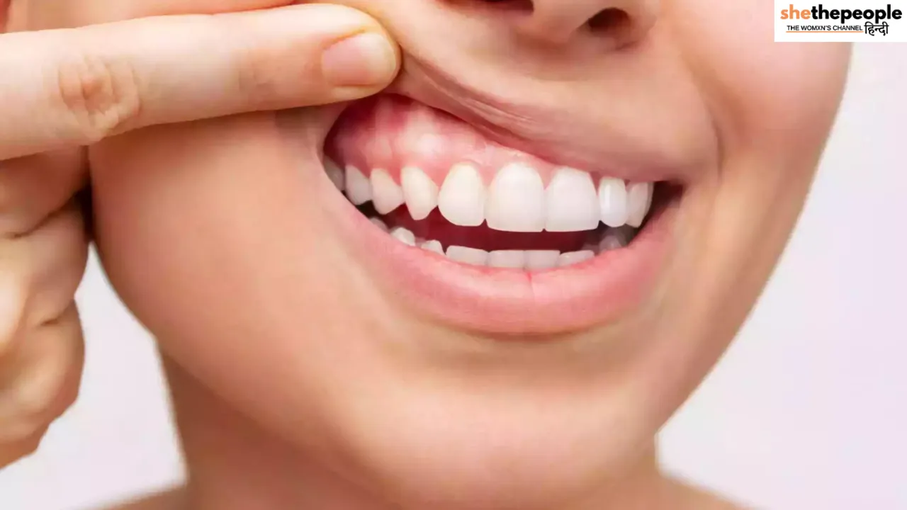 Healthy Teeth and Gums के लिए अपनाएं ये टिप्स