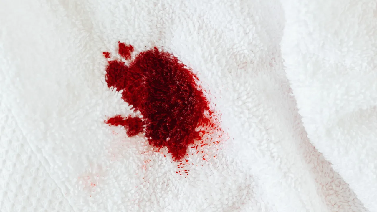 Bleeding After Sex  