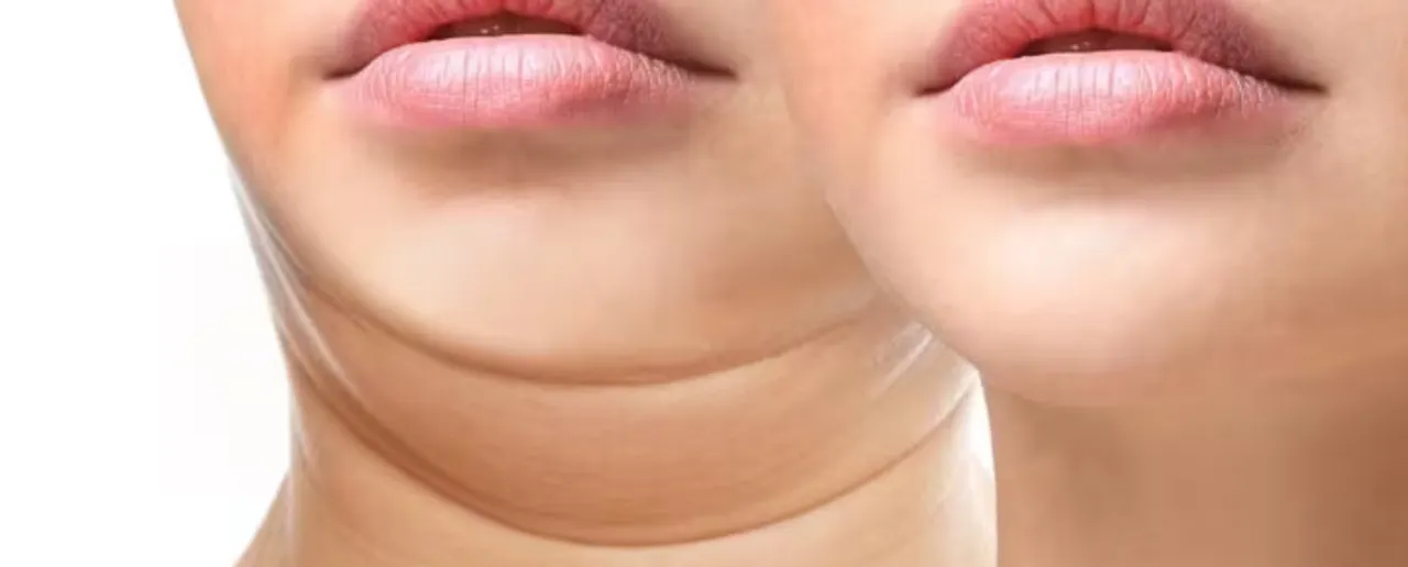 Double Chin: इन 5 टिप्स से पाएं डबल चिन से छुटकारा