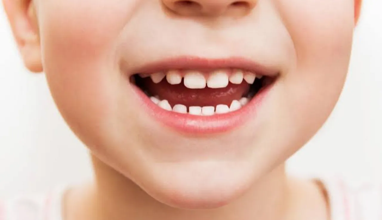 kids teeth