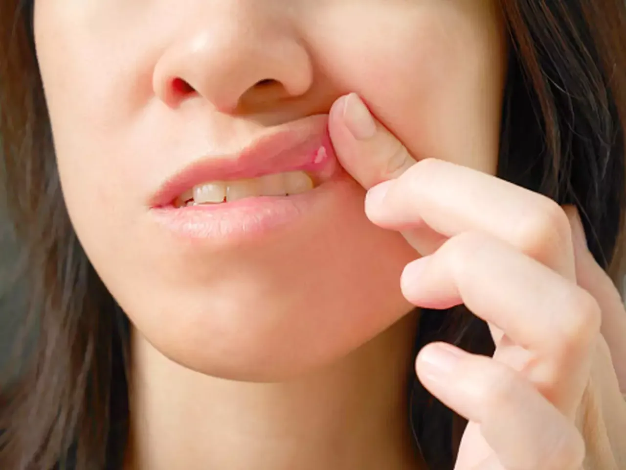 Health Tips: मुँह के छाले ठीक करने के लिए 5 घरेलू उपचार