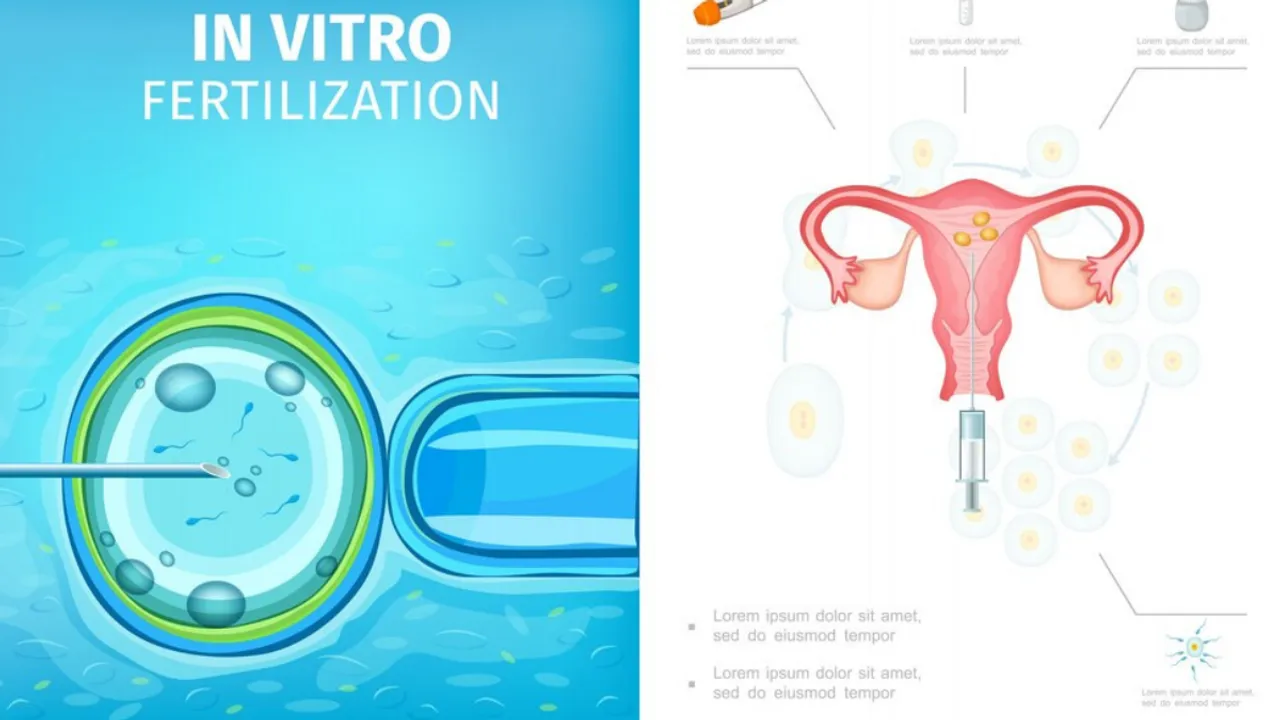 In- Vitro Fertilization(FREEPIK)