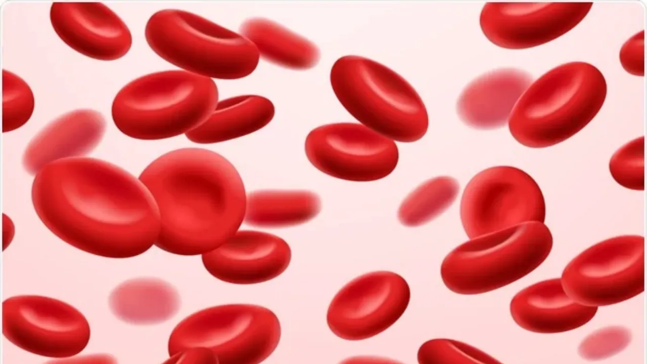 anemia  