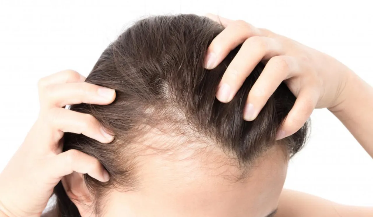 Hair Care Tips(Medical News Today)